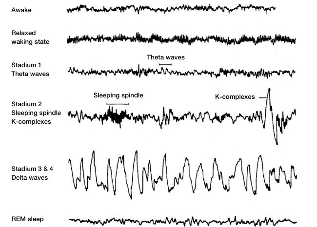 Brain waves and sleep stages overview